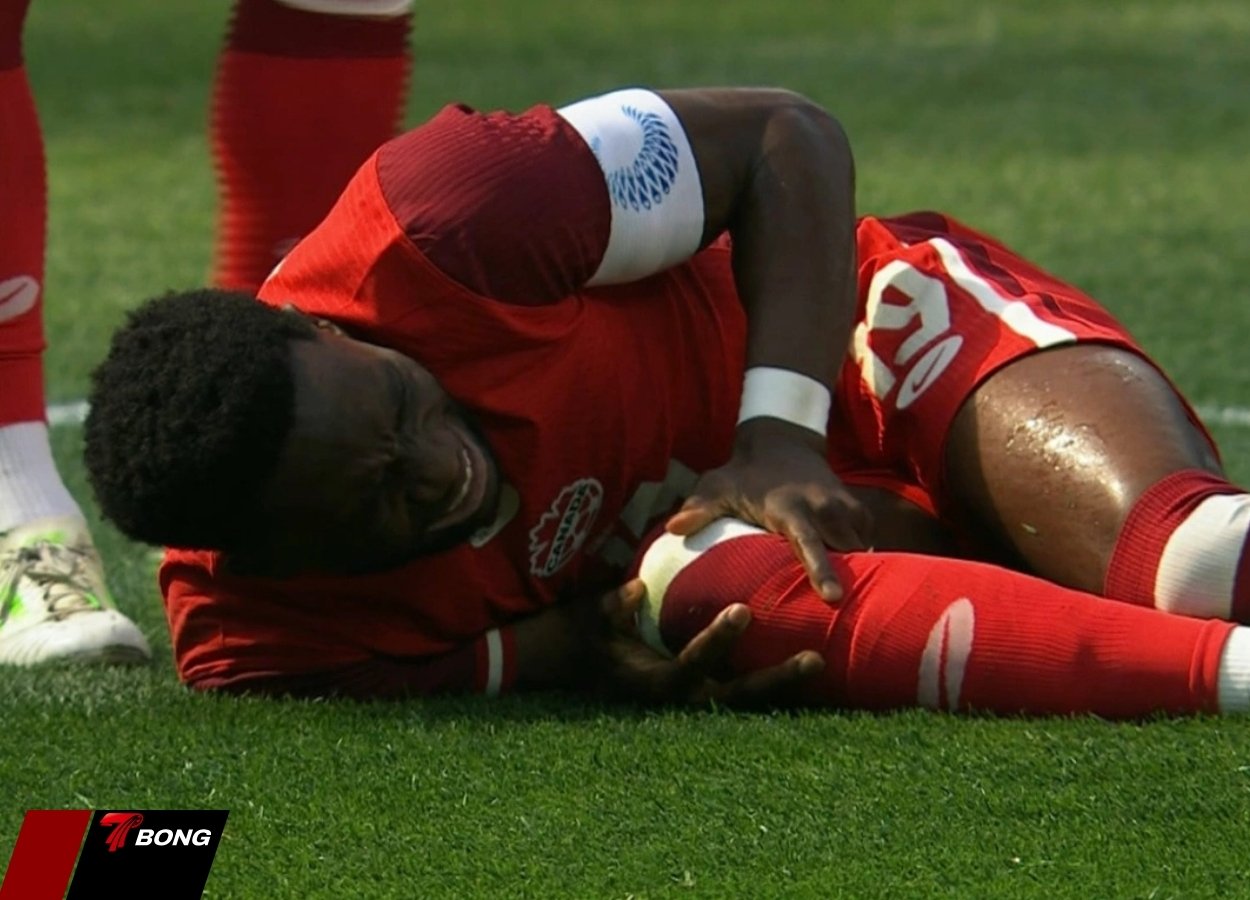 Alphonso Davies và ám ảnh chấn thương quá khứ
